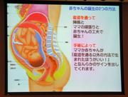 2014年度 中学2年保健学習会の画像
